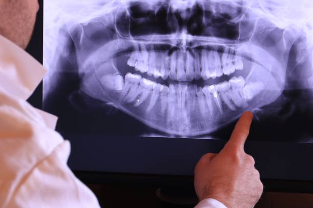 Best Emergency Dentist for Lost Fillings or Crowns in Hope, AR
